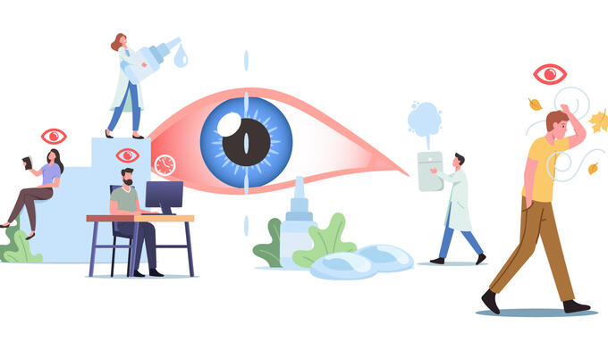 illustration of a giant eye and tiny opticians 